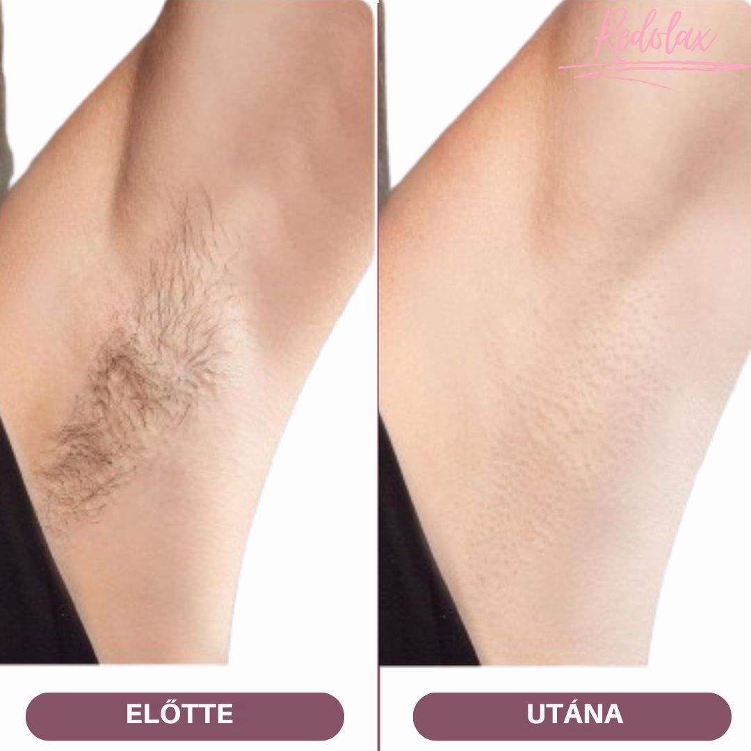 Redolax VelvetShave™