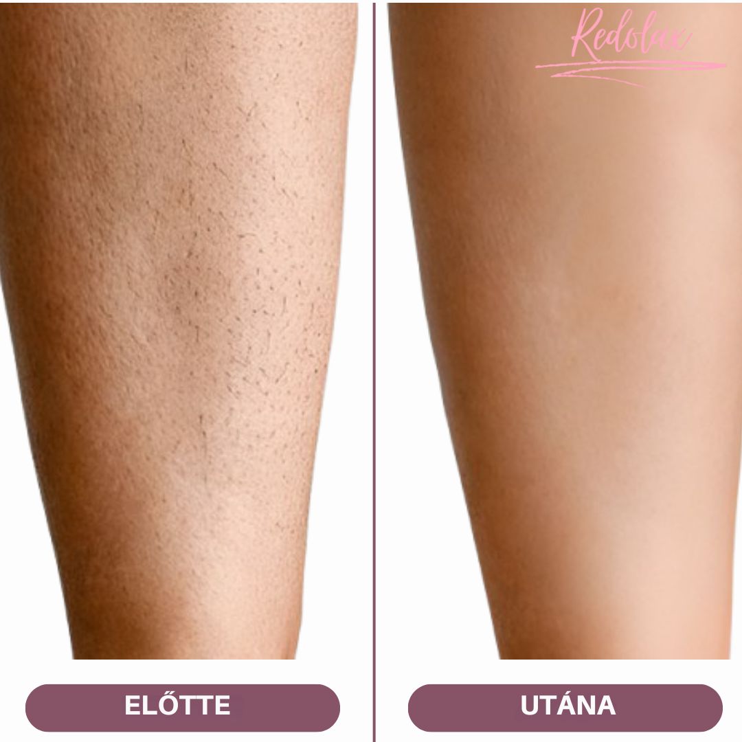 Redolax VelvetShave™
